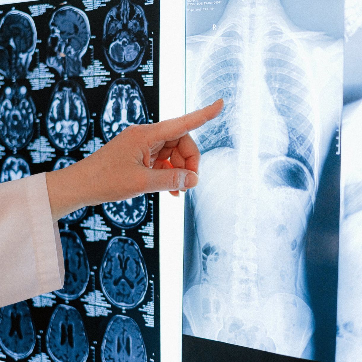 Dr. med. Matthias Urban, Lungenfunktion, Allergologie, Bronchoskopie, Onkologie, EKG, Labor, Ärztehaus, in guten Händen